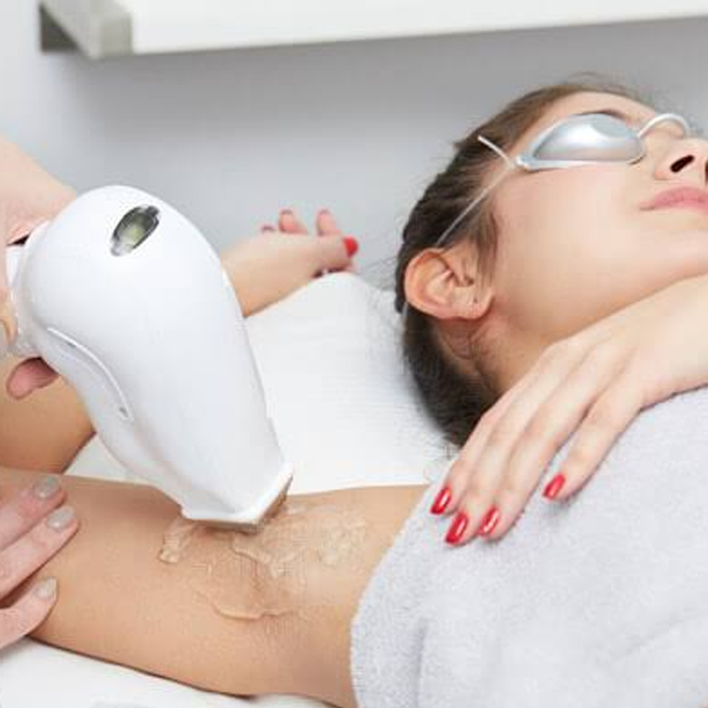 Laser Hair Removal